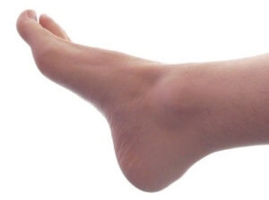 What is Tarsal Tunnel Syndrome?