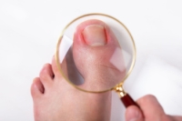 Dealing With Painful Ingrown Toenails