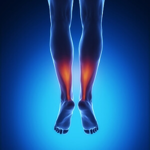 Does My Achilles Tendon Injury Require Surgery?
