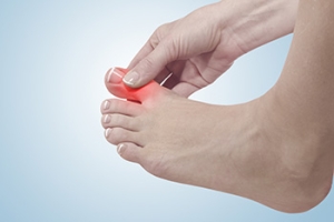 Is It Gout or a Bunion?